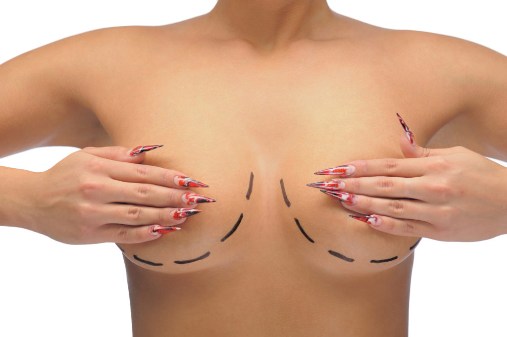 How Breast Augmentation Scars Can Cause Pain and Problems, Both Now And Later
