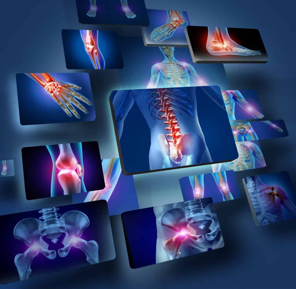 Myofascial Release Therapy Can Help With Your Back Pain 