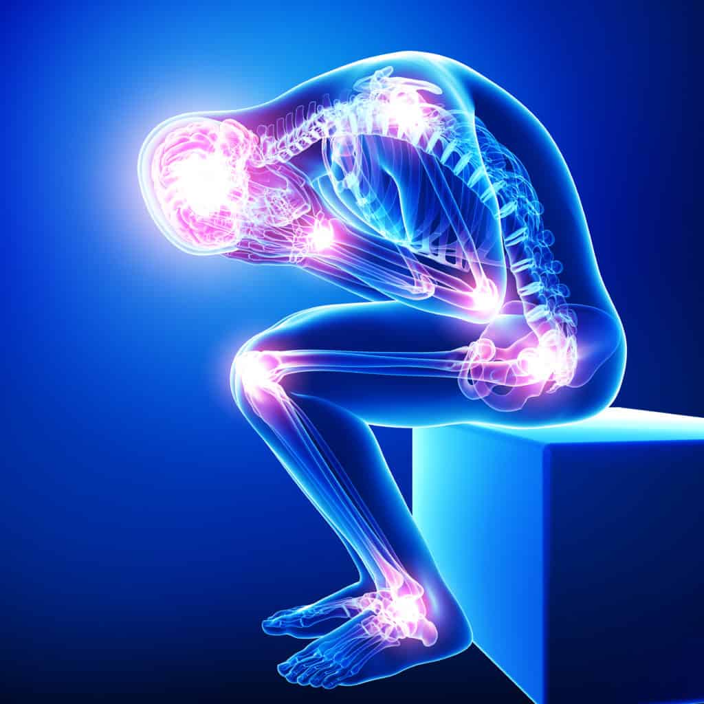 Can Myofascial Pain Syndrome Be Cured Release Works Myofascial Therapy