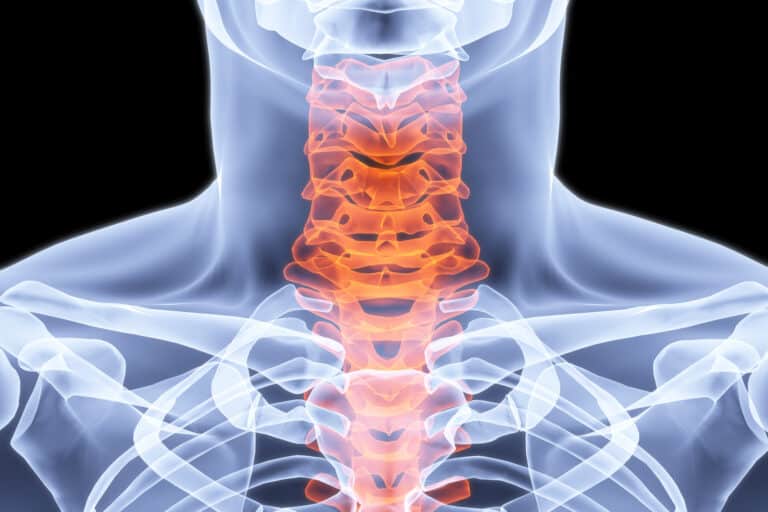 man's neck under the X-rays. bones are highlighted in red.