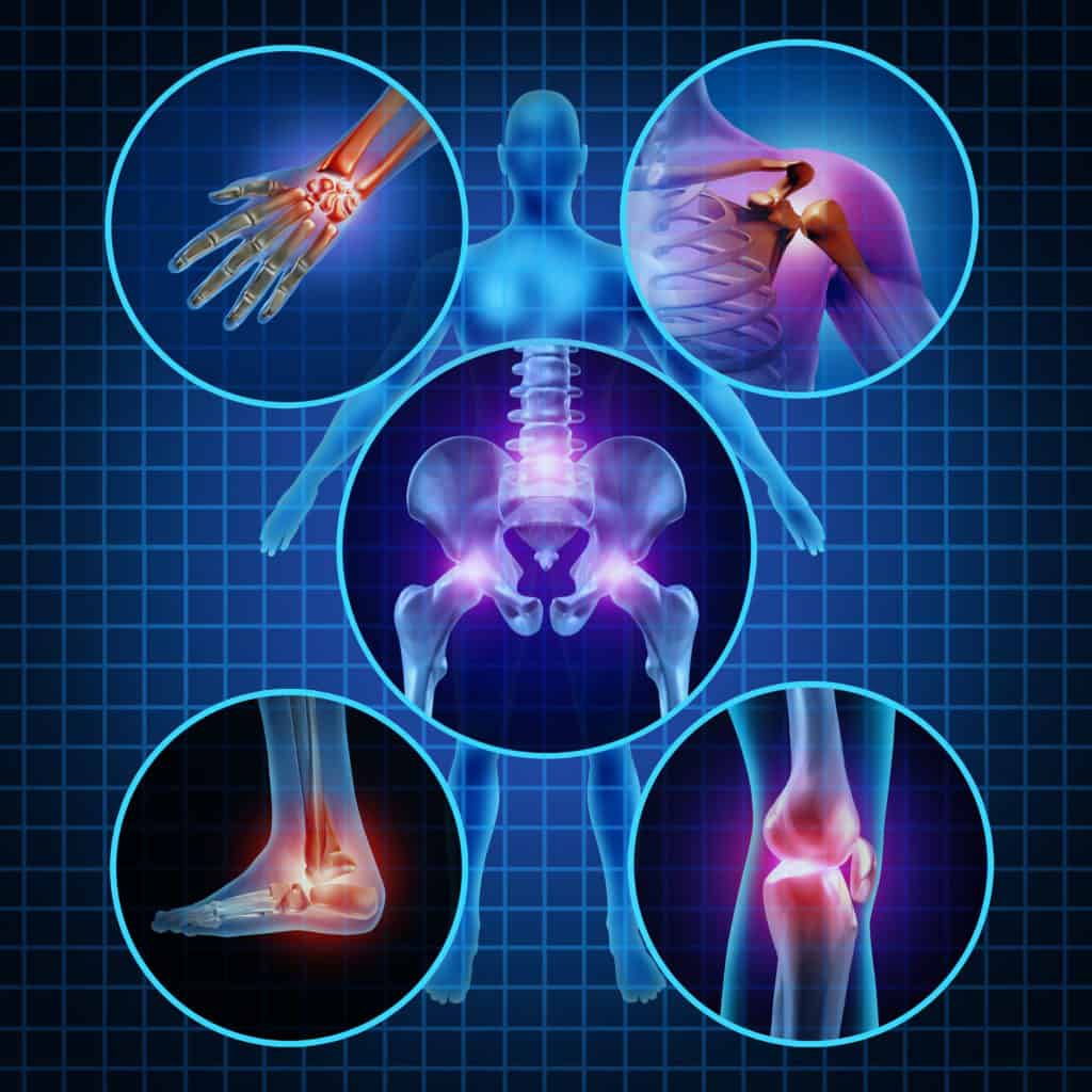 Understanding Myofascia 