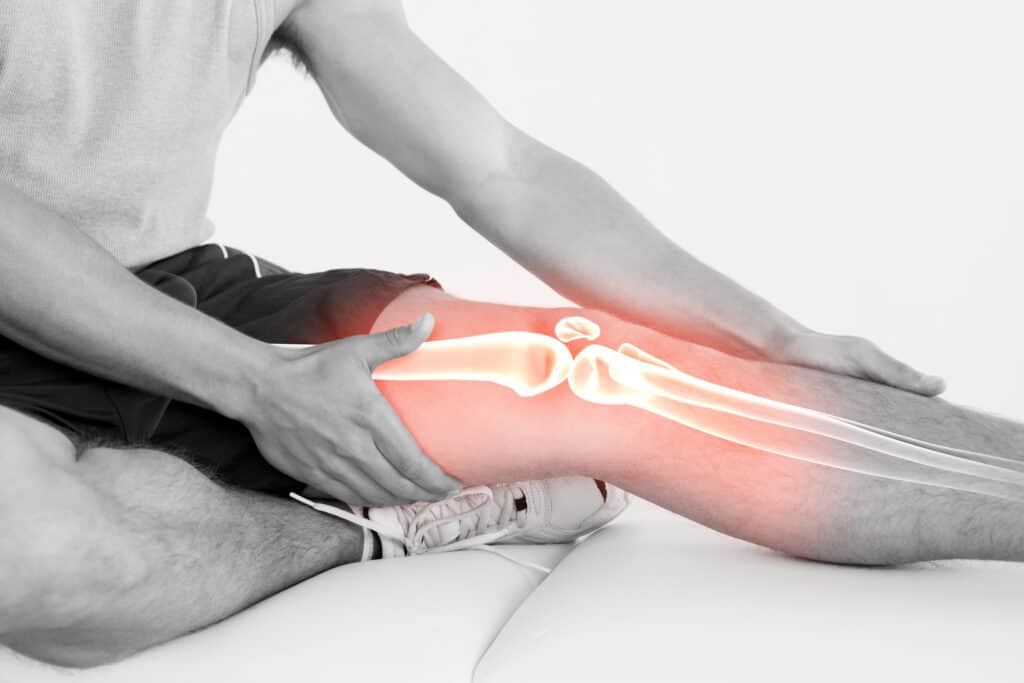 chronic myofascial pain syndrome - joint stiffness in man with x ray of knee