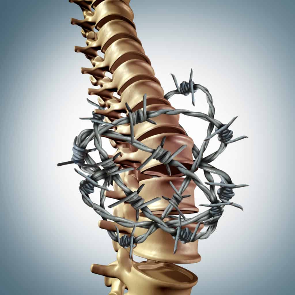 Myofascial Release Therapy for Chronic Pain