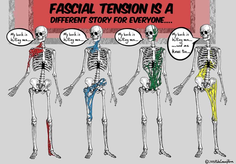 Back Pain Back Pain