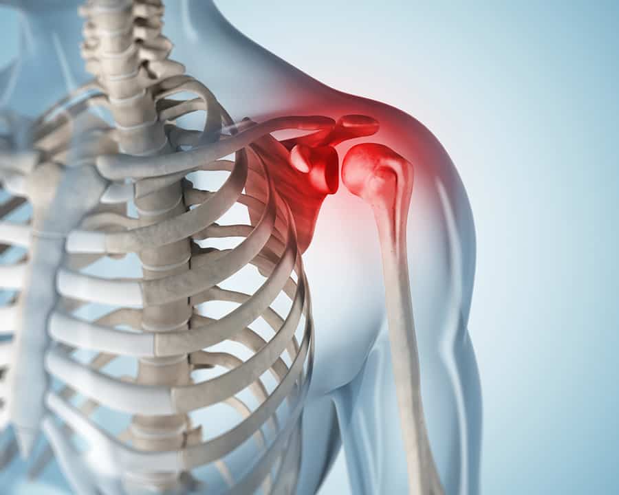 frozen shoulder release